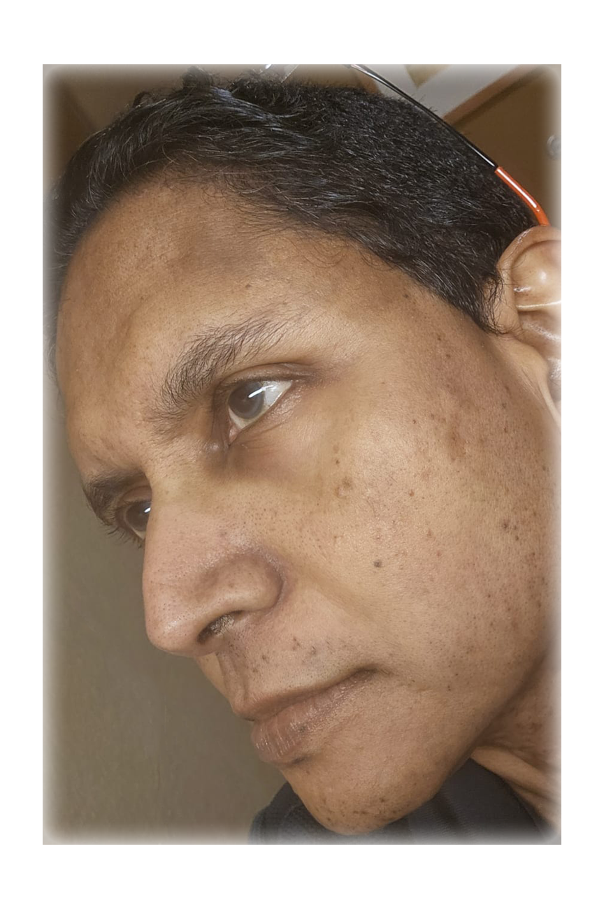 D Kumar MD